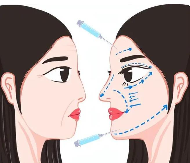 看似方便的“微整形”,却仍要警惕三个美容“陷阱”